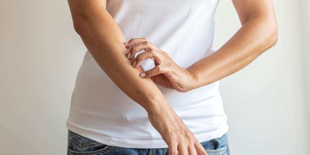 Óleo Essencial para Coceira Podem Aliviar e Acalmar a Pele