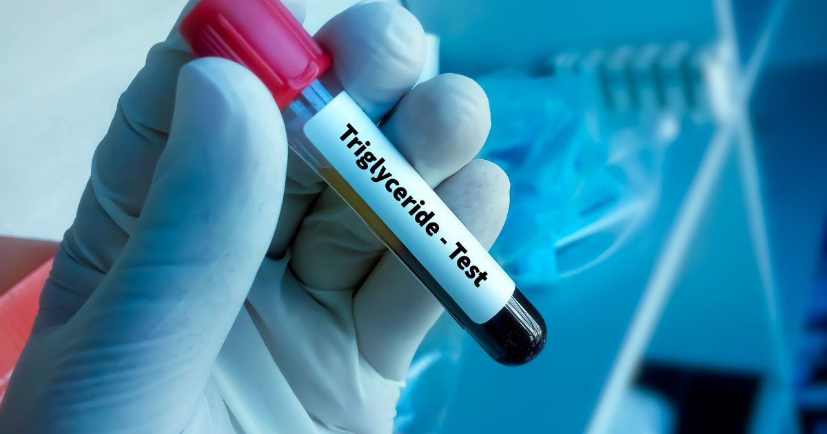 Reduzindo a Inflamação com Triglicerídeos
